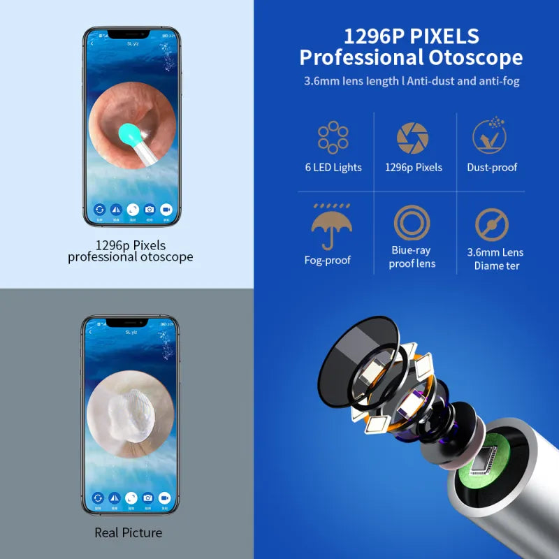 Otoscope sans fil NE3